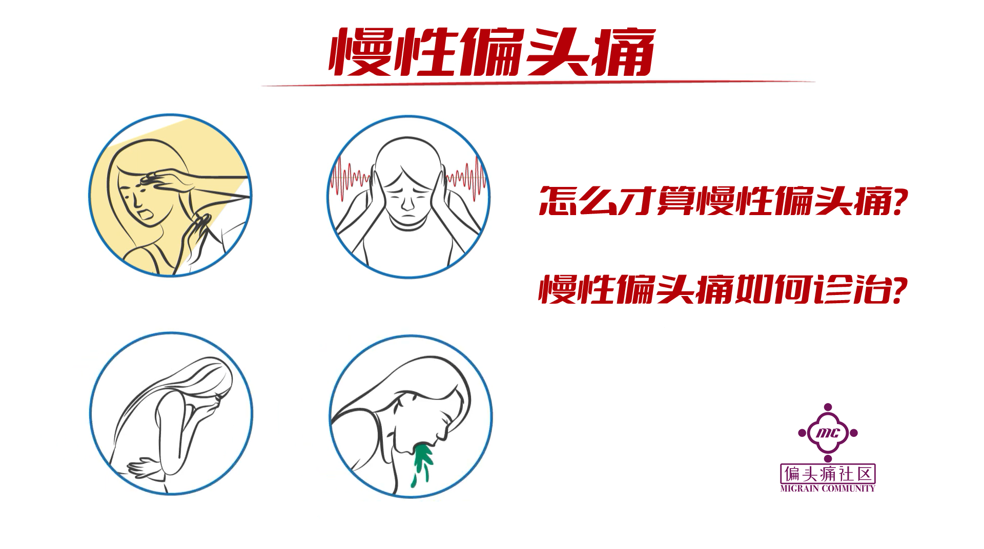 慢性偏头痛