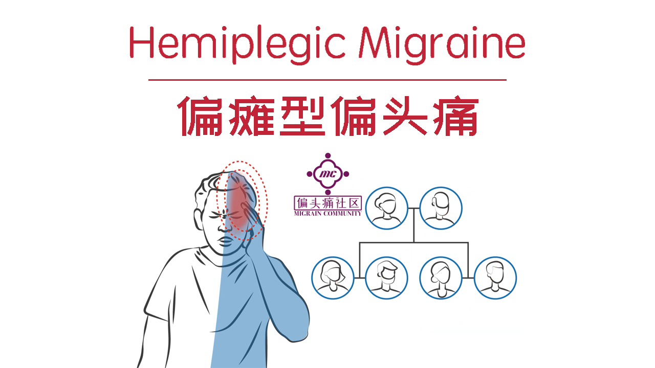 偏瘫型偏头痛