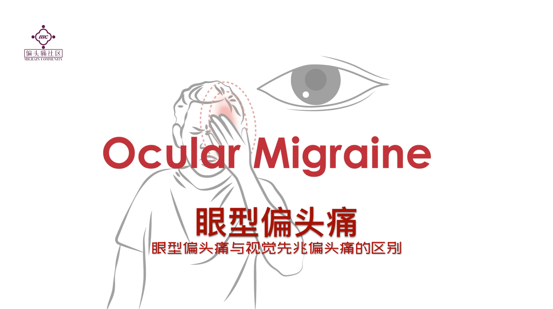 视网膜型偏头痛