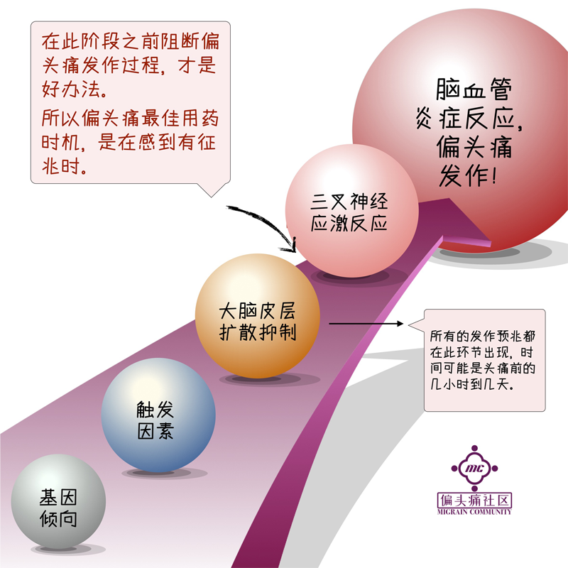 偏头痛的发病过程简述